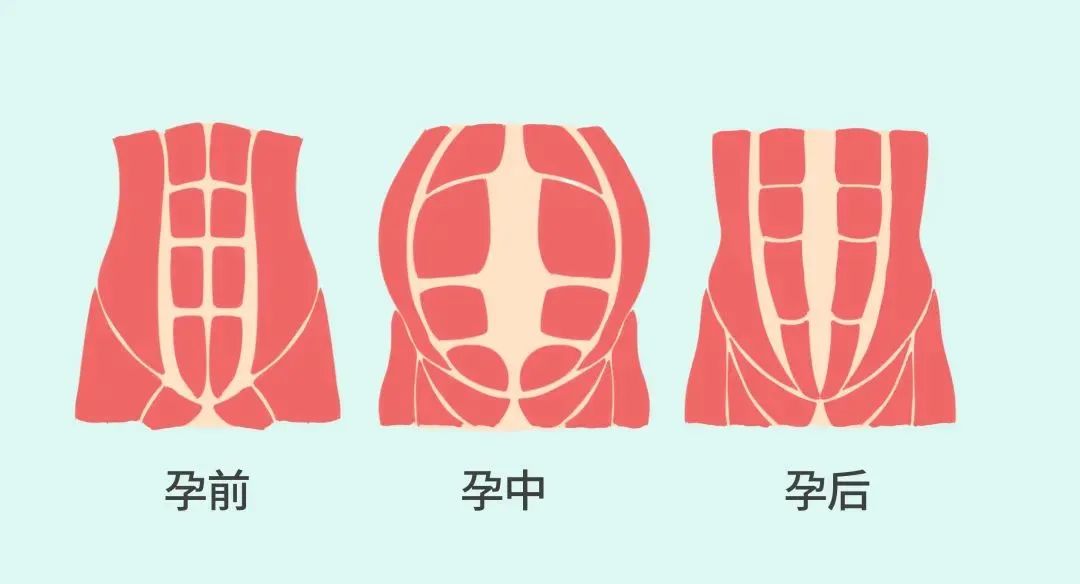 盆底訓練儀5.jpg